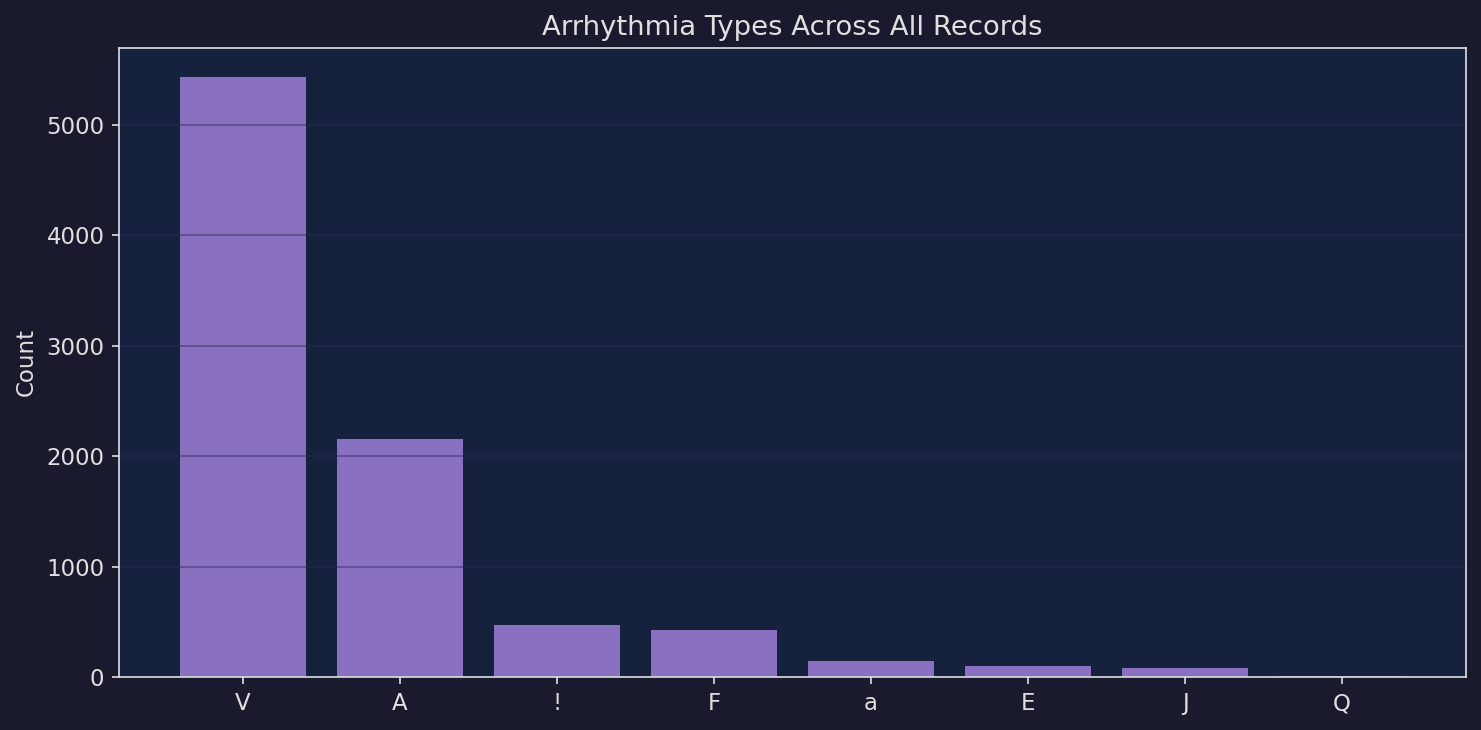 Arrhythmia type distribution