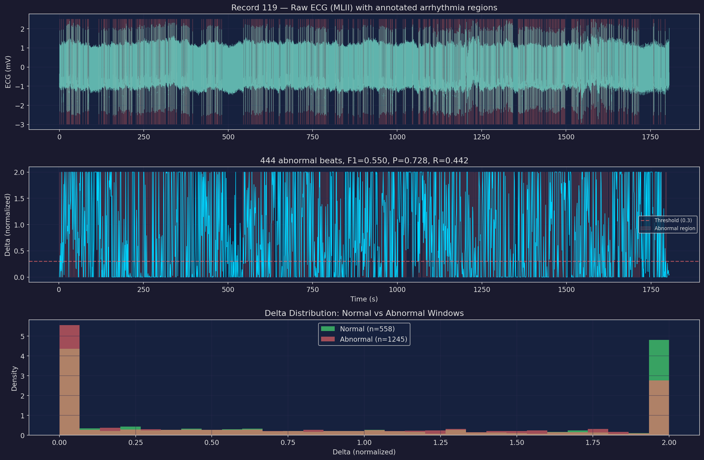 Example ECG record with coherence overlay