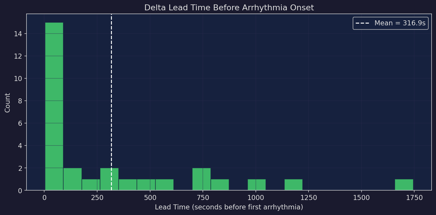 Lead time distribution